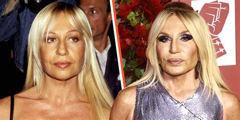 donatella gianni versace 1997|donatella versace before surgery.